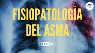 3 FISIOPATOLOGÍA DEL ASMA FISIOPATOLOGÍA RESPIRATORIA [upl. by Ledoux]