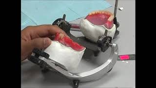 COMPLETE DENTURE 10 Teeth Setting Up  Anterior Mandibular Teeth [upl. by Wagshul386]