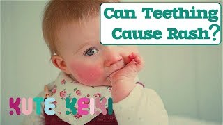 Can Teething Cause Rash in Babies  Natural Teething Rash Remedies [upl. by Tremml566]