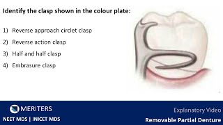 NEET MDS  INICET  Prostho  Removable Partial Denture  Explanatory Video  MERITERS [upl. by Henning]