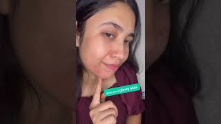 Dark spot removal natural remedy tanremoval acnetreatment acneproneskincare acnetreatment acne [upl. by Mccreery]