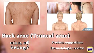 Is Body Acne your problem Products for Body Back Acne எப்படி சரி செய்வது drthamizhinian [upl. by Spracklen749]