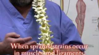 Lower back Pain sports Injuries trauma self treatment [upl. by Hewitt]