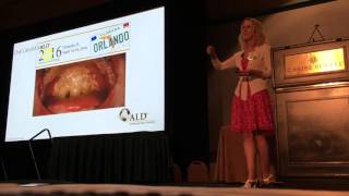 Annette Quinn  Oral Mucositis Academy of Laser Dentistry 2016 [upl. by Tterrab]