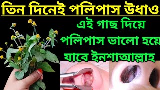 এই গাছ চিনে রাখুন নাকের পলিপাস ভালো করে দিচ্ছে। [upl. by Sorac775]