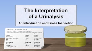 Interpretation of the Urinalysis Part 1  Introduction and Inspection [upl. by Landbert]