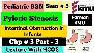 Pyloric Stenosis in URDUHindi  Pediatric Nursing  BSN Sem  5 Unit  3 part3 KMU MCQS Pattern [upl. by Hobey924]