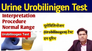 Urine Urobilinogen Test in Hindi   Ehrlichs aldehyde test [upl. by Aundrea]