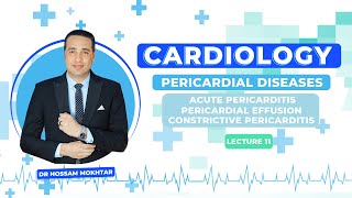 Cardiology ll Pericardial Diseases ll  Acute pericarditis amp Pericardial effusion amp CP [upl. by Michaella]