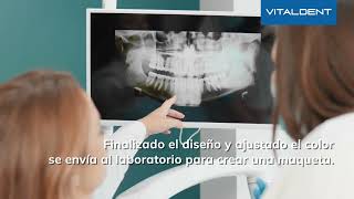 Diseño de Sonrisa La clave para una sonrisa perfecta en Vitaldent [upl. by Novyert]