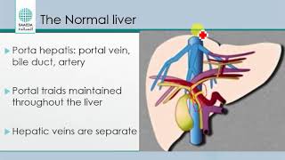 liver sonography [upl. by Nref]