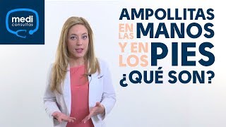 Ampollitas en las manos y los pies ¿qué puedo hacer MediConsultas [upl. by Aitnom]