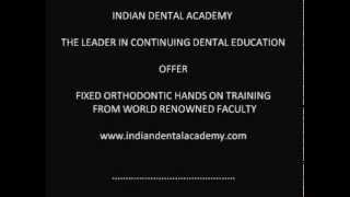 Fixed orthodontic hands on training [upl. by Tova568]