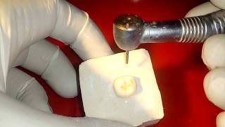 demonstration of conventional class 1 cavity preparation on mandibular molar for amalgam filling [upl. by Ecneralc662]