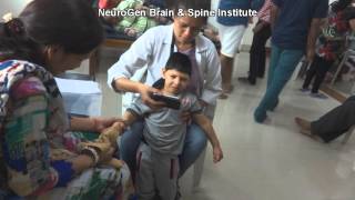 Treatment for Spastic Quadriplegia Cerebral Palsy [upl. by Folsom]