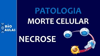 Necrose  Morte Celular Coagulação Liquefação Caseosa Gangrenosa Gordurosa Patologia Geral [upl. by Dareen]