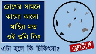 What are Floaters in eyes causes and treatment eyefloaters eyeflashesdrbhaskarDey [upl. by Tuorah]