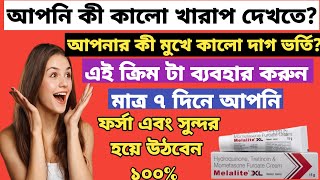 Melalite XL cream ফর্সা হওয়ার ক্রিম full review in bangla uses price dosage [upl. by Andriana]