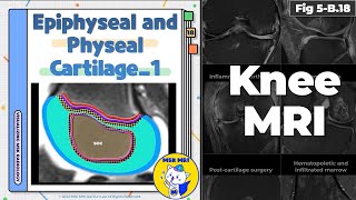 Fig 5B18 Normal Epiphyseal and Physeal Cartilage Part 1 [upl. by Carbrey]