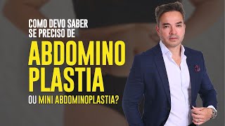 COMO DEVO SABER SE FAÇO ABDOMINOPLASTIA OU MINIABDOMINOPLASTIA [upl. by Ahsirpac]