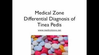 Medical Zone Differential Diagnosis of Tinea Pedis [upl. by Nosemaj]