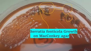 Serratia fonticola Colony Morphology on Macconkey agar of BAL sample [upl. by Siul168]