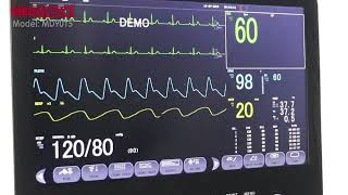 How to connect a Patient monitor to Central Monitoring System [upl. by Moth315]