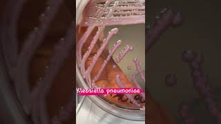 Klebsiella Pneumoniae growth on MacConkey Agar [upl. by Aiuqram]