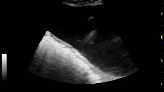 ureteral jet entering dogs bladder on ultrasonography [upl. by Akcinat395]