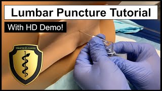 Lumbar Puncture Spinal Tap  Comprehensive Tutorial amp Demonstration [upl. by Tareyn411]