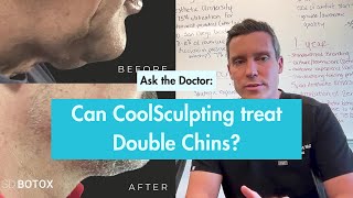 CoolSculpting A NonSurgical Solution for Your Double Chin [upl. by Yerfoeg]