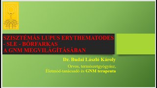 Szisztémás Lupus Erythematodes a GNM tükrében [upl. by Nahs]