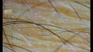 Exploring Arm Hair under the Microscope [upl. by Leunamme]