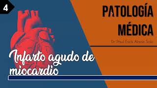 Infarto Agudo de Miocardio  Patogenia [upl. by Matthaus]