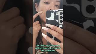 Clear Skin Fast Mighty Patch™ Original Review amp Results  Mighty Patch Original reviewHydrocolloid [upl. by Fletch207]