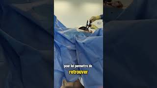 Du ciment dans les os hospital docteur neuroprotection infirmiere ciment fracture ide [upl. by Yecies]