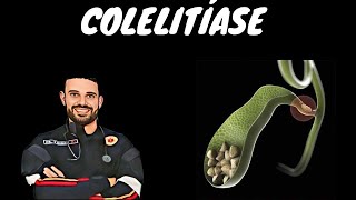 COLELITÍASE [upl. by Salahi]