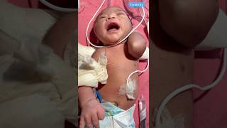 Newborn Convulsions medical viralvideo [upl. by Nayarb588]