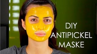 DIY ANTI PICKEL AKNE  MITESSER Maske selber machen  Heavensdream [upl. by Irac975]