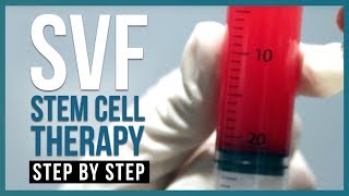 Stromal Vascular Fraction Stem Cell Therapy SVF Therapy  StepbyStep [upl. by Orfurd948]