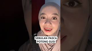 Sebulan pasca potong gusi  Part 1 [upl. by Esilana904]