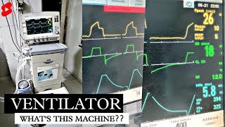 WHAT IS VENTILATOR MACHINE  HOW VENTILATORS WORKS  व्हेंटिलेटर क्या होता है  shorts ventilator [upl. by Anse]