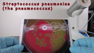 Alpha Hemolysis and Identification of Streptococcus pneumoniae [upl. by Kantor]