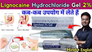 सुन्न करने वाली दवा  Lignocaine Hydrochloride Gel 2  Topical Anaesthesia  Local Anaesthesia gel [upl. by Portie484]