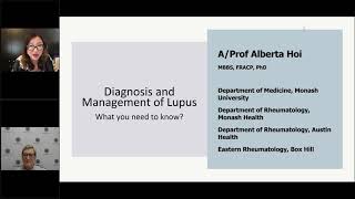 Diagnosis and management of lupus  MSK webinar series [upl. by Levon]