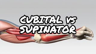 Surprising Differences Between Cubital Tunnel vs Supinator Syndrome Diagnosis [upl. by Thibaud376]