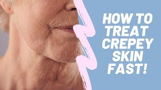 3 Powerful Ways to get rid of Crepey Skin Fast  How to Treat Crepey Skin [upl. by Anuhsal]