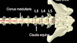 NEJM  Lumbar Puncture [upl. by Sherourd380]