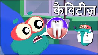 कैविटीज़  दांतों में कीड़े  Cavities In Hindi  DrBinocs Show  Educational Videos For Kids [upl. by Sokin]