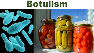 Canned Foods and Botulism What Every Consumer Should Know  Clostridium botulinum  Botulinum Toxin [upl. by Atikam]